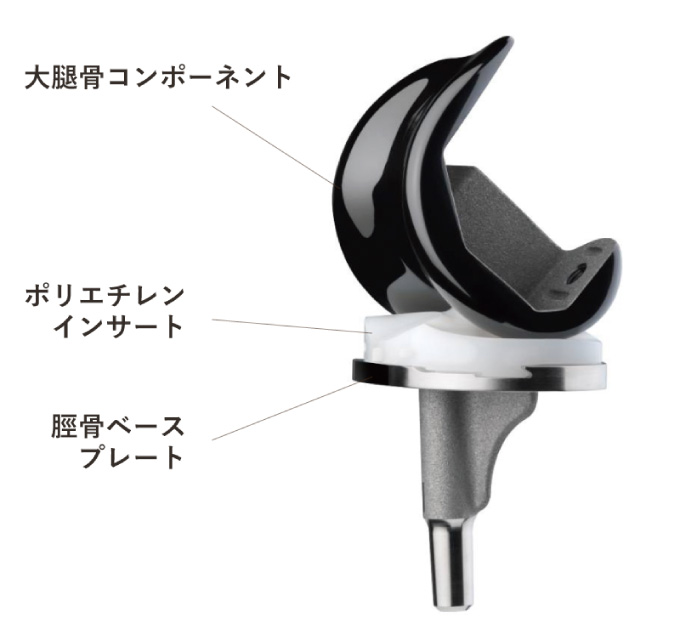 人工膝関節の図