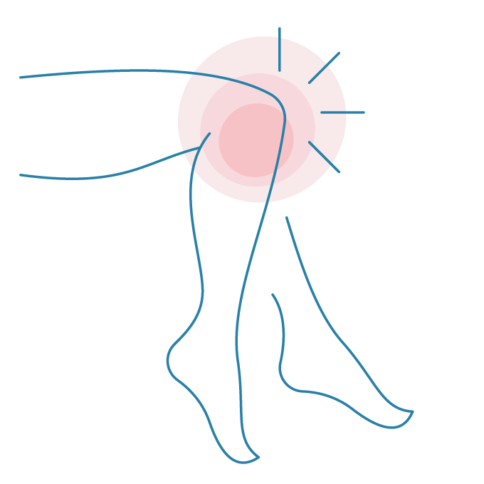 イラスト：膝の痛み